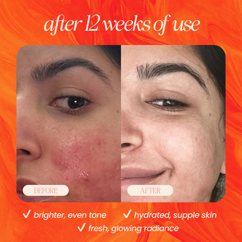Pineapple & Rosehip Vitamin C Serum - College Bath and Body
